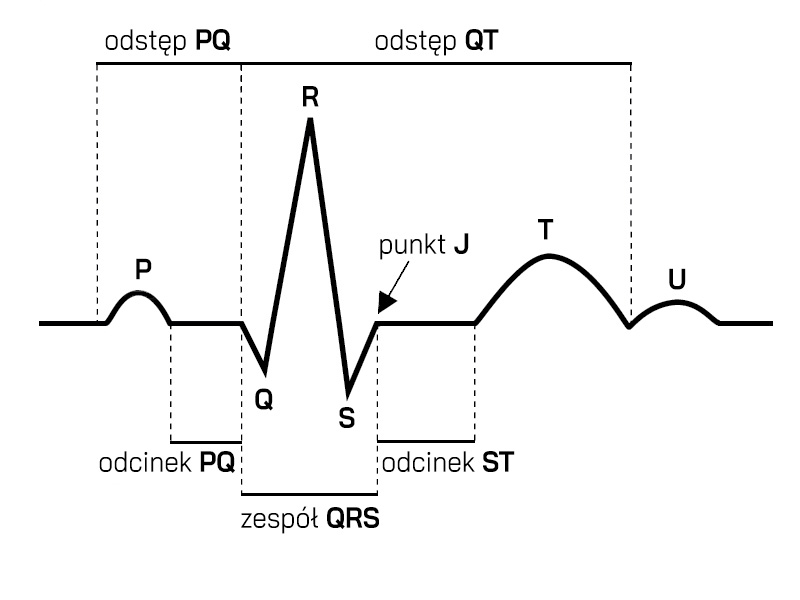 pq ekg