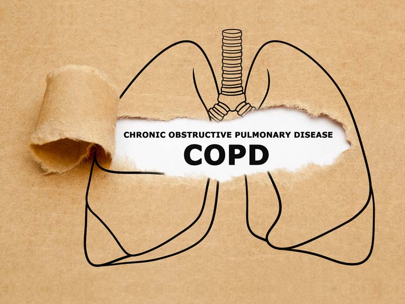 POChP – najczęstsza przewlekła choroba układu oddechowego