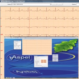 oprogramowanie do ekg, oprogramowanie do elektrokardiografu, cardioteka, aspel